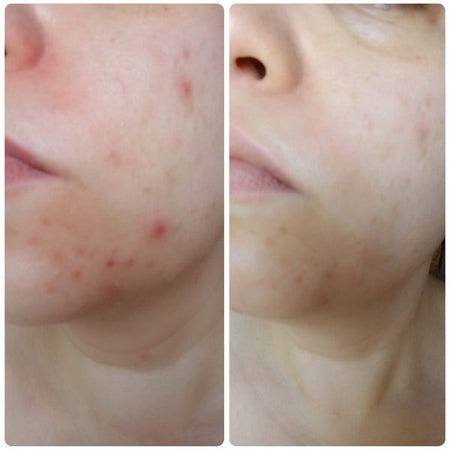 Duo Précision – 1 Masque Acheté = 1 Pinceau Offert