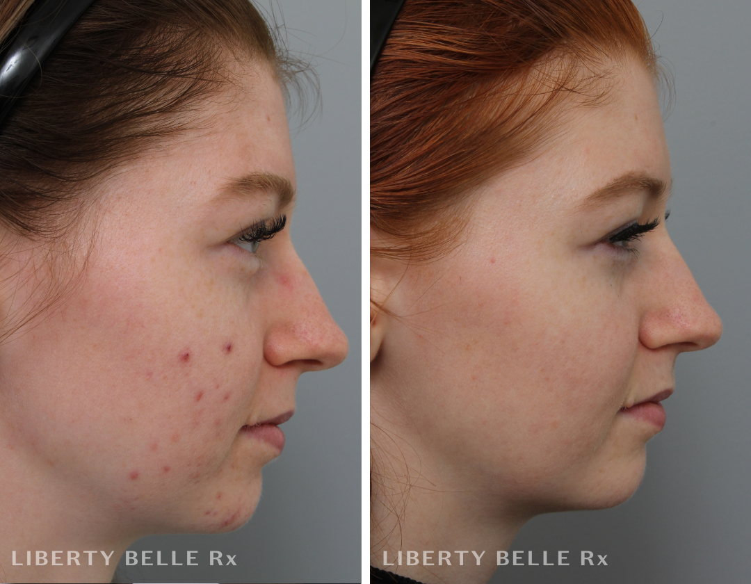 Nora K. – Peau normale